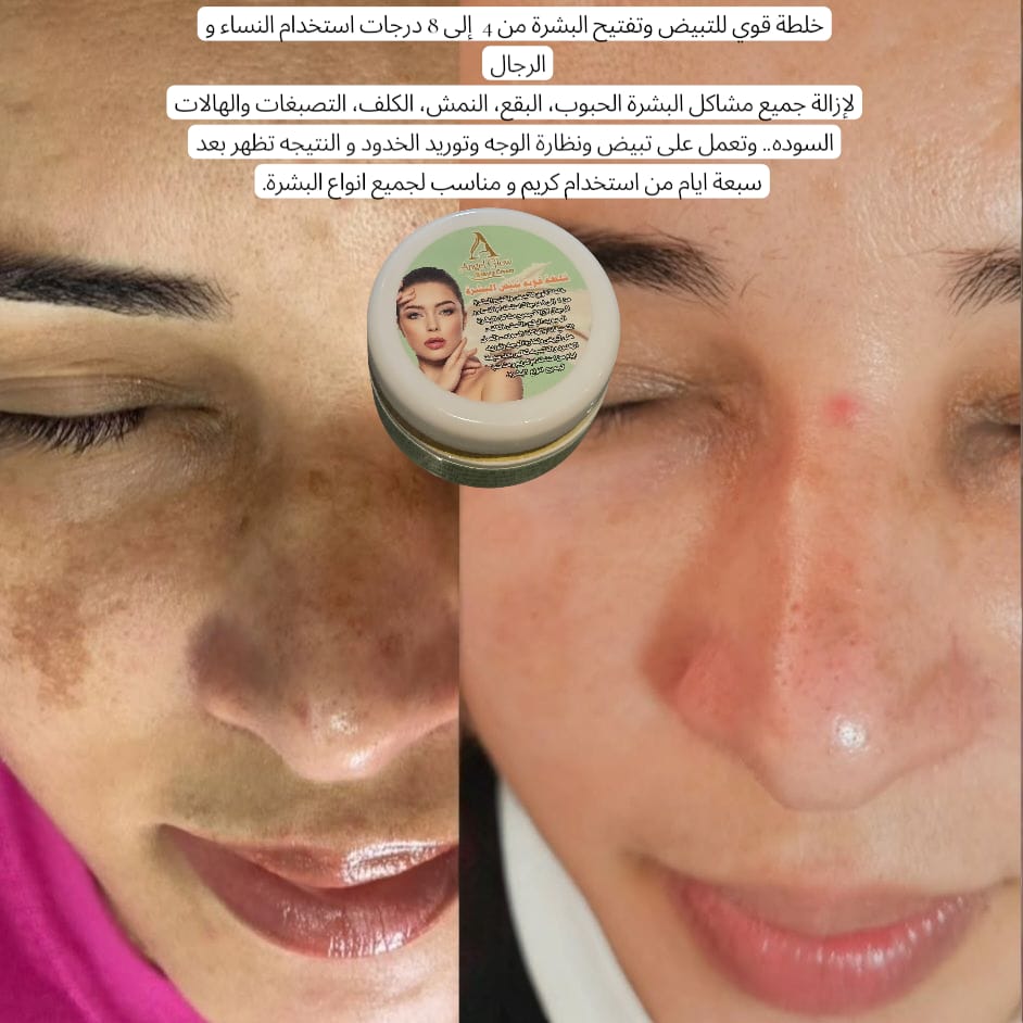 كريم أنجل جلو للتفتيح