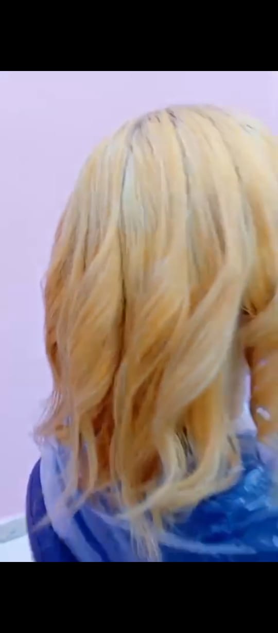 علاج العلاج للشعر